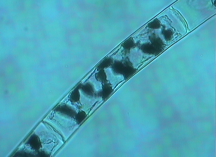 Dictyocha speculum
